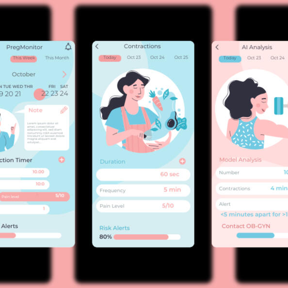 PregMonitor’s AI-powered contraction tracker in action